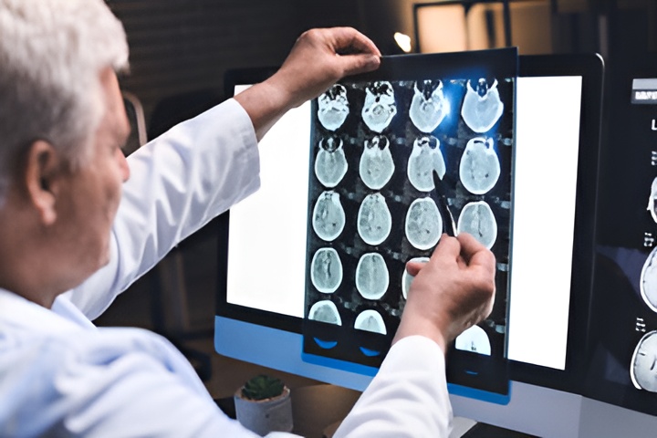 Brain injury x-ray
